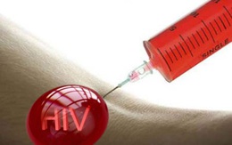 6 bước xử trí khi bị đâm kim tiêm chứa máu HIV