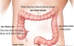 Bí quyết thoát viêm đại tràng dai dẳng không tái phát của người Nhật