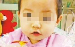 Bé gái 2 tuổi suýt mất mạng vì nghịch đũa khi đang ăn cơm