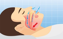 6 bệnh gần như không có triệu chứng rõ ràng ban đầu, khi phát hiện ra thì đã nặng