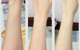 Chỉ với 1 viên B1 bạn sẽ có thần dược dưỡng trắng da tốt hơn cả những mỹ phẩm đắt tiền