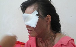 Một phụ nữ bị tạt axit tại trung tâm Sài Gòn