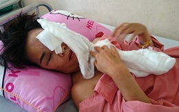 Vợ bị chồng cũ thuê người tạt axit khi chở con đi học