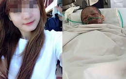 Cô gái xinh đẹp bỏng nặng do bị bạn trai tạt xăng đốt vừa qua đời
