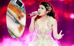 Á quân The Voice 2015 bị cướp kéo lê trên phố Sài Gòn