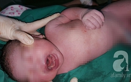 TP.HCM: Một bé gái mới sinh đã mọc... 2 răng cửa