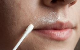 Bất ngờ với 9 công dụng làm đẹp “rẻ như bèo” từ oxy già ít người biết