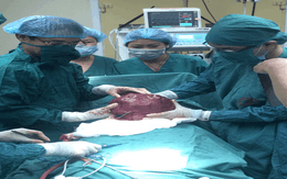 Cắt bỏ khối u nặng 4kg trong bụng bệnh nhân