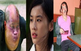 Bi kịch dàn sao "Tuyệt đỉnh Kungfu": Người bệnh tật, kẻ không có nhà để ở