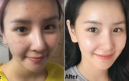 Con gái Hàn da sạch mụn, bóng mịn là nhờ có công thức pha toner với nước để rửa mặt