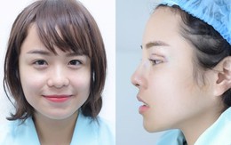 Thái Trinh thừa nhận sửa mũi, cắt mí để cải thiện nhan sắc