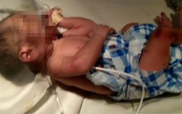 Bị anh họ cưỡng hiếp nhiều lần, cô bé 14 tuổi sinh con rồi vứt bé qua cửa sổ