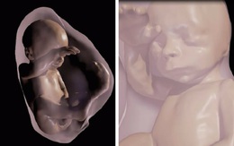 Lần đầu tiên cha mẹ có thể gặp thai nhi qua thực tế ảo 3D
