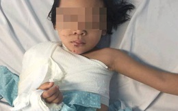 Cứu bé gái 5 tuổi bị dập nát cánh tay do tai nạn giao thông