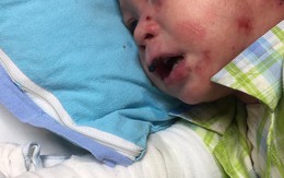 Bé trai bị bỏ rơi sau 24 giờ tuổi: 20 ngày cấp cứu bệnh nặng trong bệnh viện