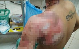 Giận vợ, chồng tưới xăng dọa đốt nhà, lửa bùng cháy gây bỏng cho cả đứa con mới hơn 2 tuổi
