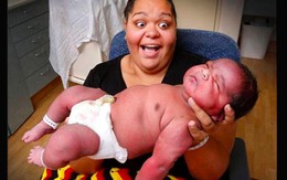 Sản phụ sinh con nặng… 6,8kg mà không cần dùng thuốc gây tê