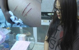 Phút ám ảnh của nữ sinh tố bị rạch đùi phải uống thuốc phơi nhiễm HIV