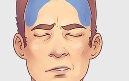 5 loại đau đầu thường gặp cần có cách chữa ngay lập tức