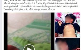 Sáng mai thông tin chính thức vụ bé gái 4 tuổi bị đánh bầm tím tại trường