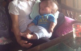 Sự sống mong manh của bé trai 5 tháng tuổi mắc căn bệnh não úng thủy