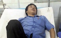 Hệ thống điện phát nổ, nhiều công nhân bị thương