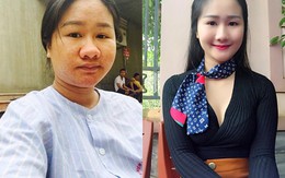 Bà bầu xấu "hiếm có khó tìm" đẹp mơn mởn khi giảm 32kg