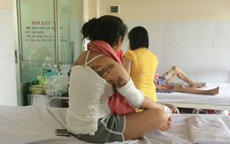 Bị bạn trai cũ tạt axit khi có người tình mới