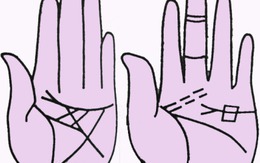Tự xem số phận qua bàn tay: Những hình quan trọng trong bàn tay
