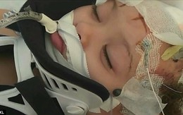 Bé gái 2 tuổi tổn thương não vì bị bảo mẫu là một cậu thiếu niên 16 tuổi trừng phạt