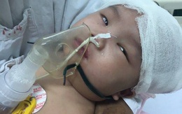 Bé gái hơn 6 tháng tuổi chấn thương sọ não do ngã võng