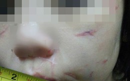 Bác sĩ tâm lý 'mổ xẻ' vụ bố, mẹ kế bạo hành bé trai 10 tuổi