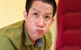 Bị cáo giết người đập đầu vào vành móng ngựa