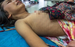 Bố mẹ bỏ đi, bé 7 tuổi một mình chăm chị gái trên giường bệnh