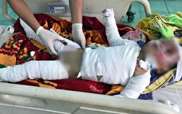 Cháy nhà lúc ba mẹ đi làm, 2 anh em nhỏ thương vong