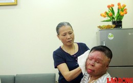 Chiến sĩ sống sót vụ rơi trực thăng muốn có tay giả để không bị gọi “người ngoài hành tinh“