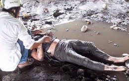 Chủ xe phân khối lớn bốc cháy trên QL 1A nguy cơ nhiễm trùng cao do nhảy xuống vũng sình