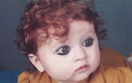 Sinh ra bị coi là "quái vật" vì ngoại hình khác thường, 20 năm sau ai cũng phải trầm trồ vì sắc đẹp của cô