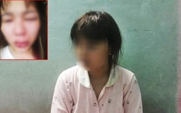 Giúp đỡ người bị thương, cô gái bức xúc vì bị đánh lệch sống mũi, rách miệng
