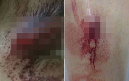 Cô gái bị đánh chảy máu đầu vì thử đồ nhưng không mua ở chợ sinh viên