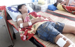 Đang đứng trước nhà, một học sinh lớp 10 bị chém nhập viện