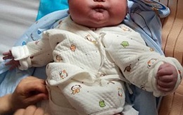 Được bác sĩ thông báo trước nhưng bố mẹ vẫn không thể ngờ con sinh ra thế này