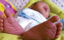 Em bé vừa chào đời, bác sĩ đặt vào túi nhựa trả về cho gia đình chôn cất thì điều ngạc nhiên xảy ra
