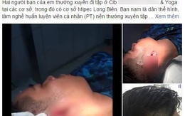 Hà Nội: Thanh niên tố bị nhiều huấn luyện viên Yoga đánh gẫy tai vì đi theo bạn gái vào phòng tập