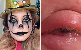 Cô gái suýt mù mắt sau khi hóa trang dịp Halloween
