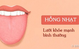 Bằng cách kiểm tra lưỡi mỗi ngày, rất có thể bạn sẽ phát hiện sớm những căn bệnh mình đang gặp phải