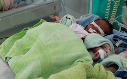 Bé gái sinh non bị bỏ rơi trong túi nylon