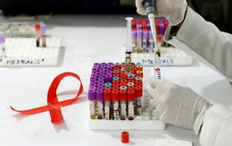 “HIV sẽ không bao giờ bị loại trừ  nếu không có nghiên cứu khoa học”