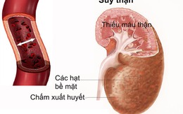 Suy thận nhẹ, dùng thuốc thế nào?