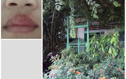 Đình chỉ nhà trẻ tư thục nơi bảo mẫu “bạo hành trẻ” bằng ớt